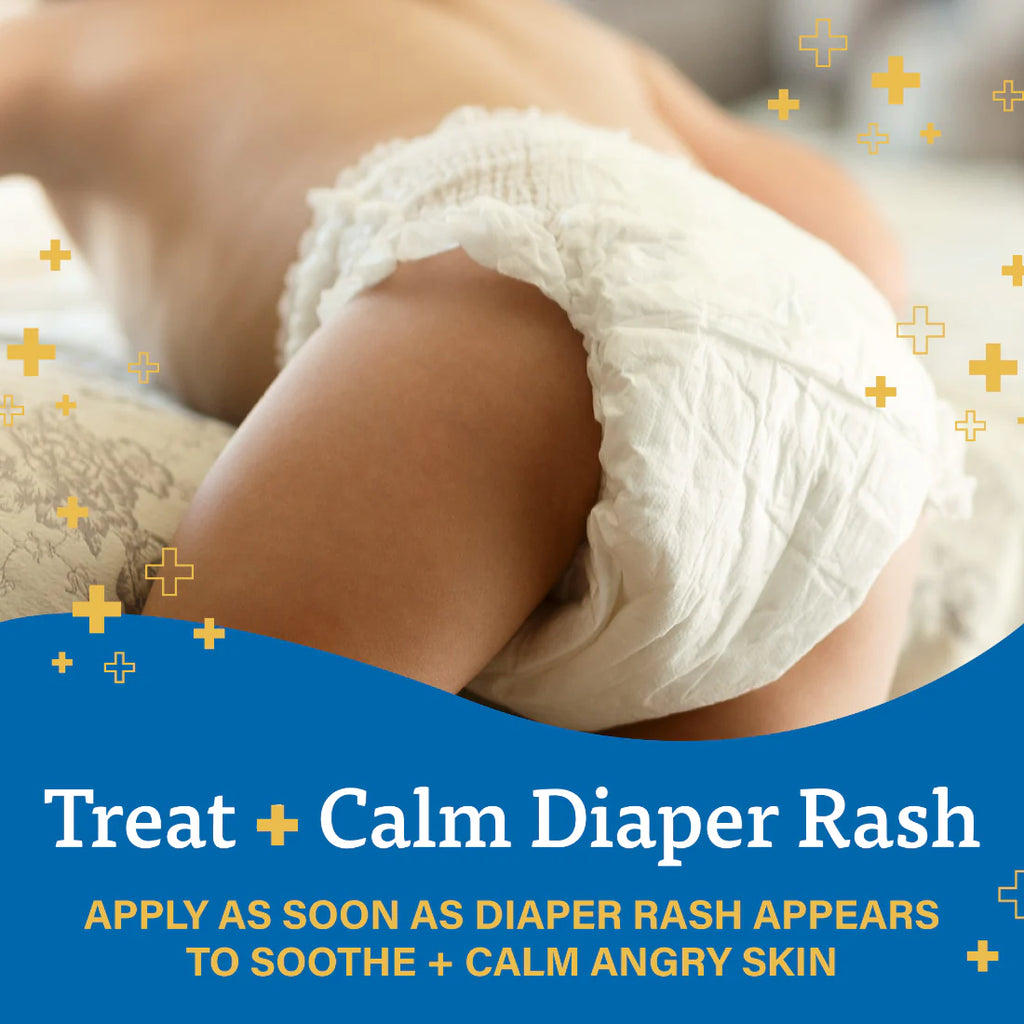 A+D Treat & Heal Diaper Rash Ointment (113g)